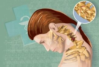 Reflex symptoms of cervical osteochondrosis